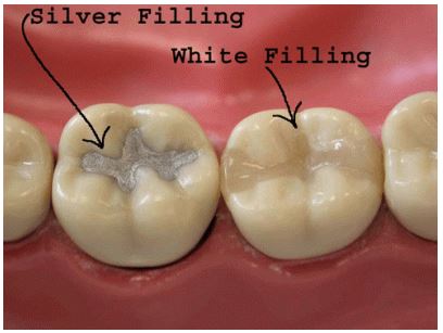 Dental Implants in Vadodara